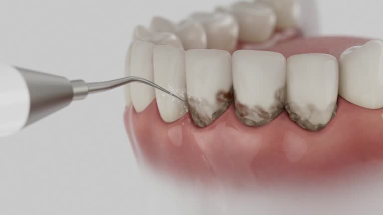 Reliable Dental Implants contractor in Gaston, SC by Smile Center Dentistry